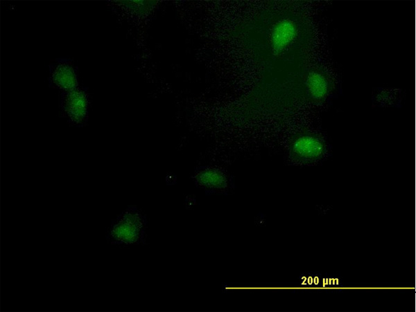 IF - GTF2E2 Antibody (monoclonal) (M01) AT2286a