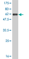 WB - GTF2E2 Antibody (monoclonal) (M01) AT2286a