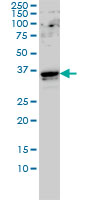 WB - GTF2E2 Antibody (monoclonal) (M01) AT2286a