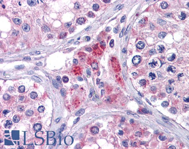 IHC - EYA4 Antibody (N-Term) AF2468a