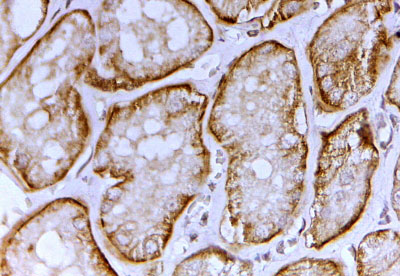 IHC - SLC26A1 / SAT-1 Antibody (C-Term) AF3992a