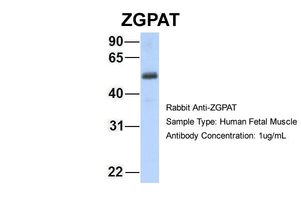 WB - ZGPAT antibody - C-terminal region AI12140