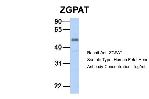 WB - ZGPAT antibody - C-terminal region AI12140