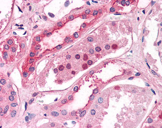 IHC - SLC39A14 / ZIP14 Antibody (Internal) ALS11177
