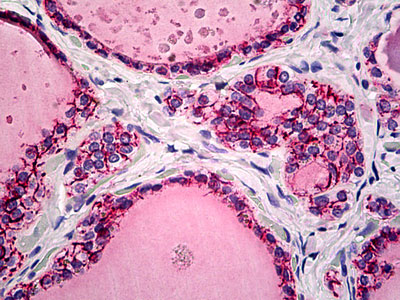 IHC - CLDN7 / Claudin 7 Antibody (C-Terminus) ALS13895