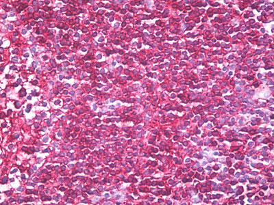 IHC - CD45RB Antibody (aa79-88, clone MEM-143) ALS15213