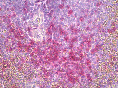 IHC - CD45RO Antibody (clone UCHL-1) ALS15257