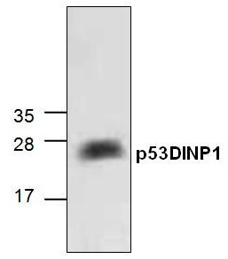 WB - p53DINP1 Antibody ABV10250-30