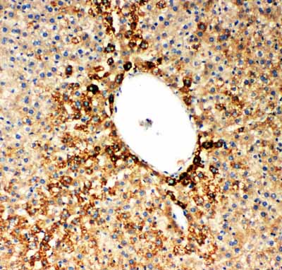 IHC - Anti-SDHA Antibody ABO10632