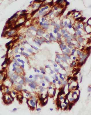 IHC - Anti-SDHA Antibody ABO10632