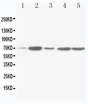 WB - Anti-SDHA Antibody ABO10632