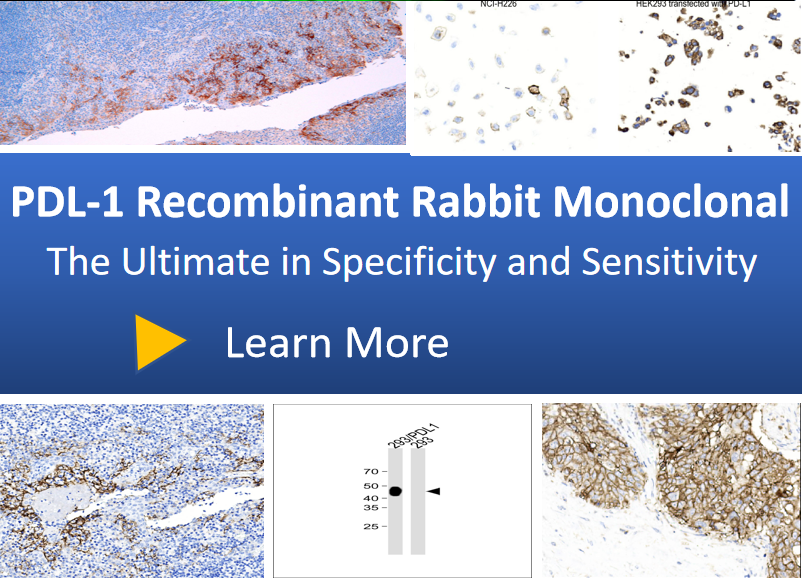 AP80075-Recombinant-PD-L1AC37-Rabbit-mAb