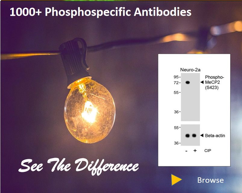 Phospho-Antibodies