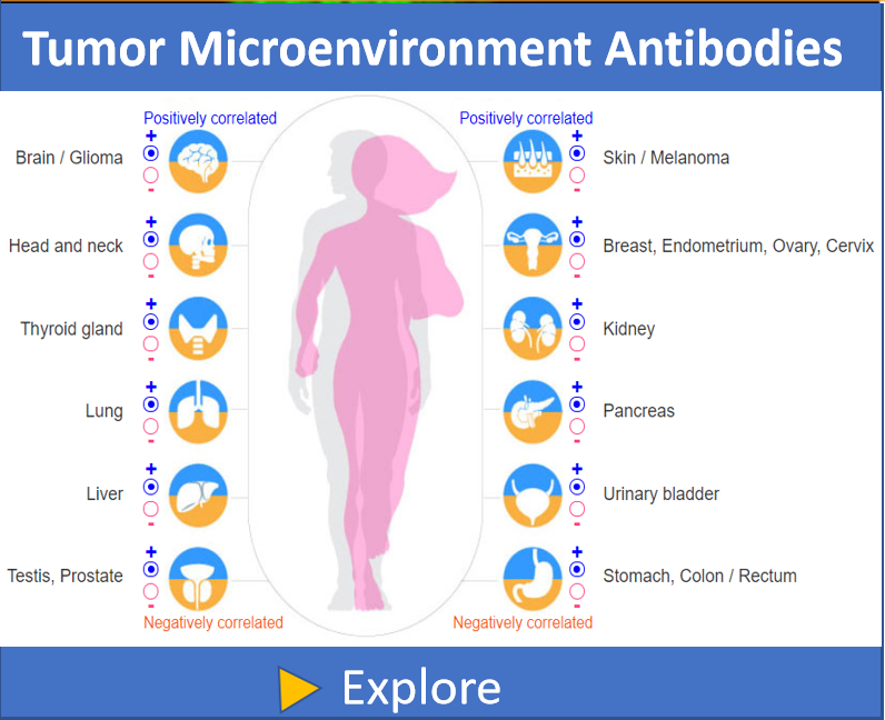 Tumor-Microenvironment-Prognostic-Genes