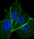 Target of the Week - HER2 (ErbB2) Antibodies