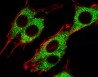 Target of the Week - PINK1 (PARK6) Antibody