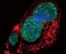 Target of the Week - SNAIL and SLUG Antibodies