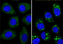 LC3 Antibody (APG8B)