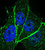 Phospho-ERBB2(T1172) Antibody (AP3781h)