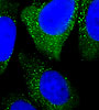 ATG5 Antibody (AP1812b)