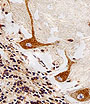 AP20658c AKT1/2/3 Antibody (Center)