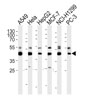 AP20615c INHBA Antibody