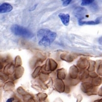 IHC-P - Recombinant Anti-GLUT1 Rabbit mAb  AP94847