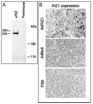 A) Rat B50 brain tumor cell extracts were immunoprecipitated with RIZ1 antibody (cat# AP1202b) or preimmune (ref.9). B)Immunohistochemical analysis of RIZ1 in adenovirus-transduced tumor cells. Established HCT116 xenograft tumors at day 2 after infection of AdRIZ1, Adnull, or buffer alone were processed for RIZ1 in situ detection (TUNEL) analysis (ref.10).