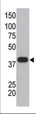 The anti-SUMO1 polyclonal antibody (Cat. #AP1222a) is used in Western blot to detect GST-SUMO1 fusion protein.