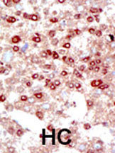 IHC-P - SUMO2/3 Antibody (C-term) AP1224a