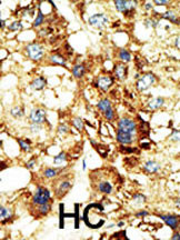 IHC-P - Dnmt3a Antibody AP1034a