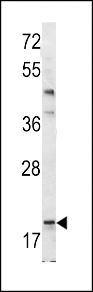 Western blot analysis of Bad BH3 Domain antibody (Cat.# AP1322a) in mouse bladder tissue lysates (35ug/lane). Bad (arrow) was detected using the purified Pab.