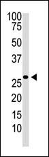 The anti-DKK2 Pab (Cat. #AP1522a) is used in Western blot to detect DKK2 in Jurkat cell lysate.