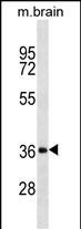 WB - DKK2 Antibody (N-term) AP1522a