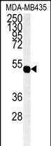 Western blot analysis of hGJA7-H104.Connexin (Cat. #AP1547a) in MDA-MB435 cell line lysates (35ug/lane).GJA7 (arrow) was detected using the purified Pab.