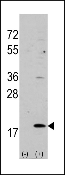 WB - VILIP3 Antibody (N-term) AP1563a