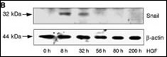 WB - SNAI1 Antibody (N-term D24) AP2054a