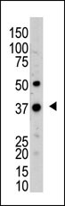 The anti-UCHL5 Pab (Cat. #AP2128a) is used in Western blot to detect UCHL5 in mouse kidney tissue lysate.
