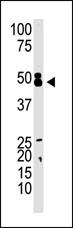 The anti-CBX8 C-term Pab (Cat. #AP2515b) is used in Western blot to detect CBX8 in mouse kidney tissue lysate.