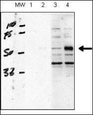 human chondrocytes (C28/I2 cells), transfected with empty vector (lane 1, 3) or ACVRL1(lane 2, 4).  RIPA lysis buffer, 20 ug/lane of protein, primary antibody dilution 1:1000, blocking solution is 5% milk in TBST (lane 1 and 2), 5% BSA in TBST (lane 3 and 4).  Data courtesy of Kenneth Finnson, Montreal General Hospital.
