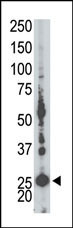 The anti-AK5 Pab (Cat. #AP8131a) is used in Western blot to detect AK5 in mouse liver tissue lysate.