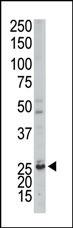 The anti-AK3 Pab (Cat. #AP8132b) is used in Western blot to detect AK3 in mouse kidney tissue lysate.