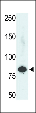 The anti-PFKL Pab (Cat. #AP8136b) is used in Western blot to detect PFKL in HepG2 cell lysate.