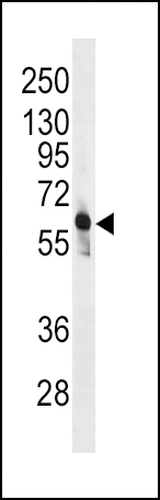 WB - PFKFB3 Antibody (C-term) AP8145b
