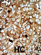 IHC-P - PFKFB3 Antibody (C-term) AP8145b