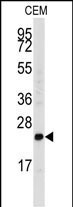 Western blot analysis of anti-FGF4 Antibody (C-term) (Cat.#AP8149b) in CEM cell line lysates (35ug/lane). FGF4 (arrow) was detected using the purified Pab.