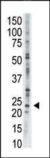 The anti-AK1 Pab (Cat. #AP8160b) is used in Western blot to detect AK1 in CHO cell lysate.