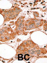 IHC-P - Bcl-G BH3 Domain Antibody AP1304a