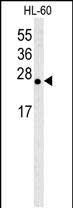 Western blot analysis of anti-Bcl-w BH3 domain Pab (Cat. #AP1305a) in HL-60 cell lysate. Bcl-w BH3 domain (arrow) was detected using purified Pab. Secondary HRP-anti-rabbit was used for signal visualization with chemiluminescence.