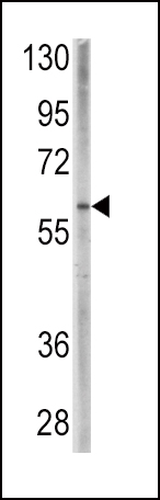 WB - BMPR1A Antibody (C-term) AP2004B